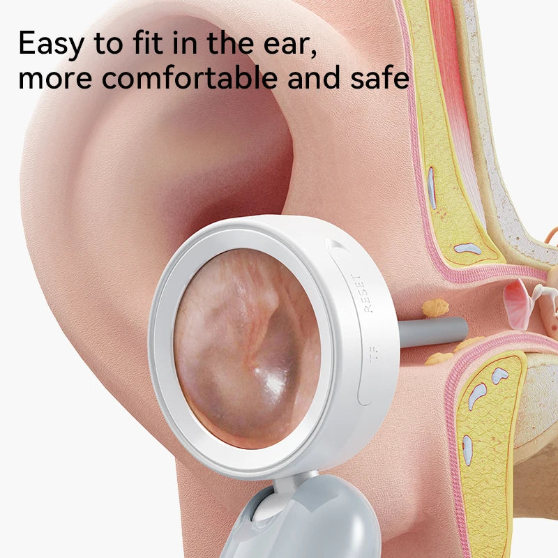 Otoscope Ear Camera with 1.38'' Screen1080P Ear Scope with 4 LEDs Support Photo and Video Ideal Pocket Otoscope for Adults Kids