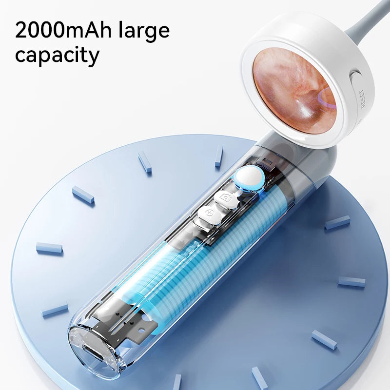Otoscope Ear Camera with 1.38'' Screen1080P Ear Scope with 4 LEDs Support Photo and Video Ideal Pocket Otoscope for Adults Kids